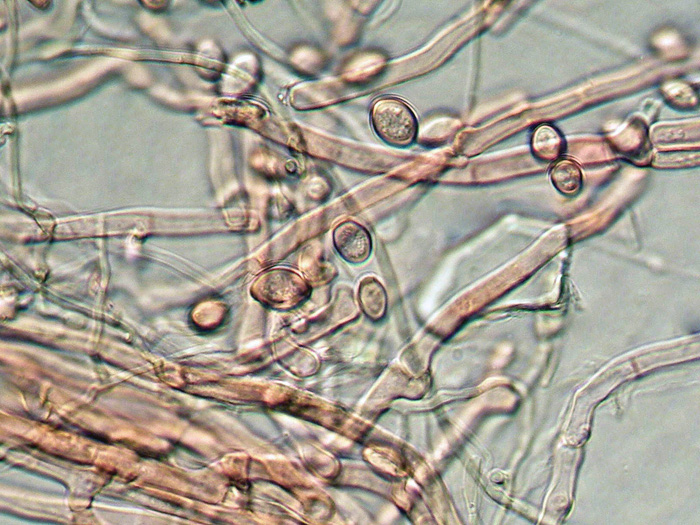 Haplotrichum da determinare
